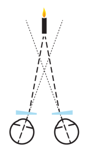 Visualtraining Dortmund - Winkelfehlsichtigkeit Abb. 4